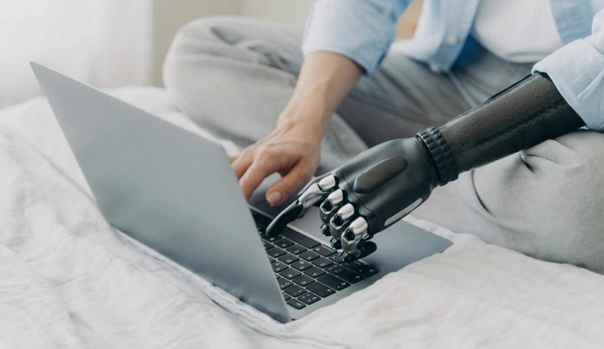 Close up of disabled woman working on laptop, typing on keyboard, using bionic prosthetic arm