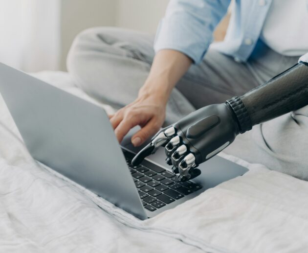 Close up of disabled woman working on laptop, typing on keyboard, using bionic prosthetic arm