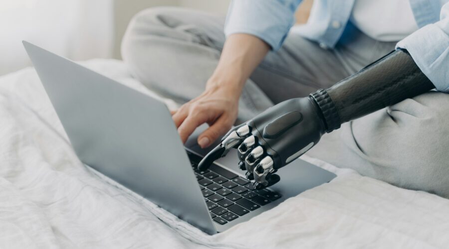 Close up of disabled woman working on laptop, typing on keyboard, using bionic prosthetic arm