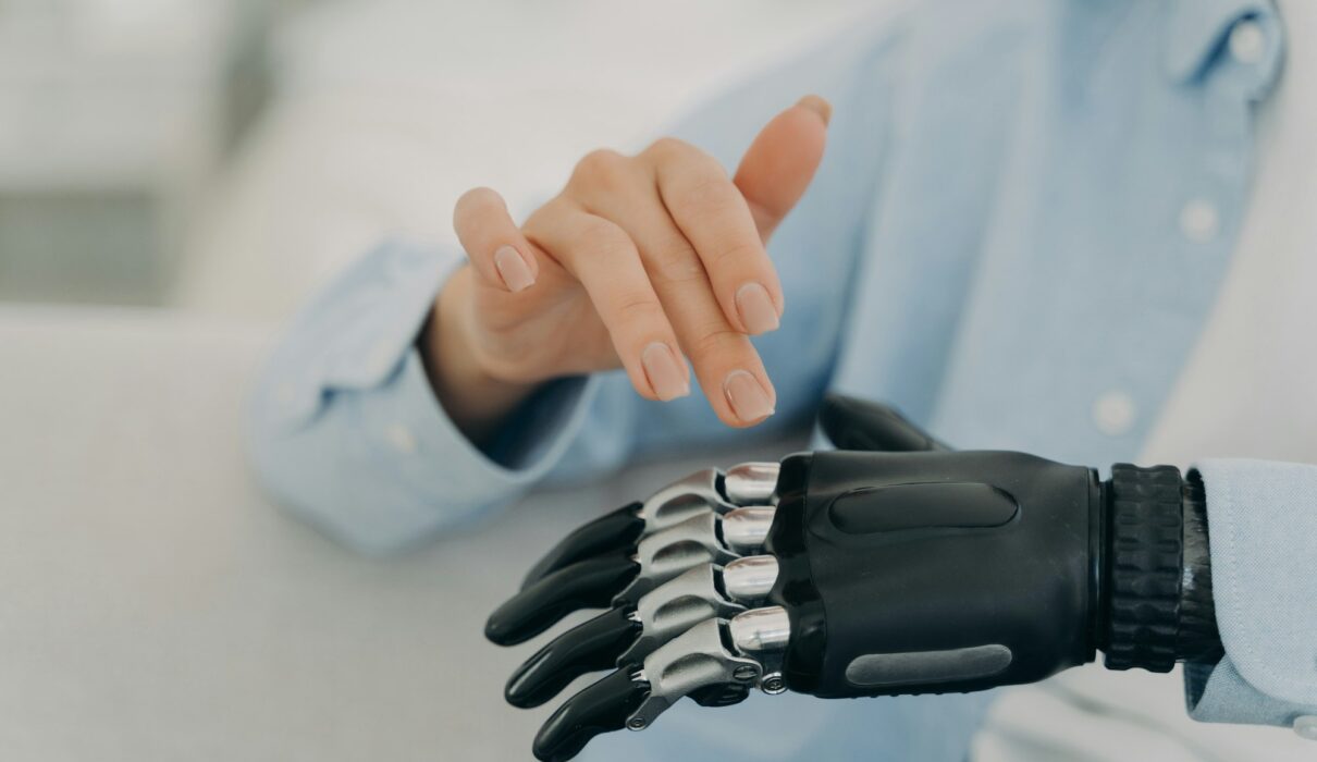 Disabled female use prosthesis of hand, artificial limb, closeup. Disability, high tech medical care