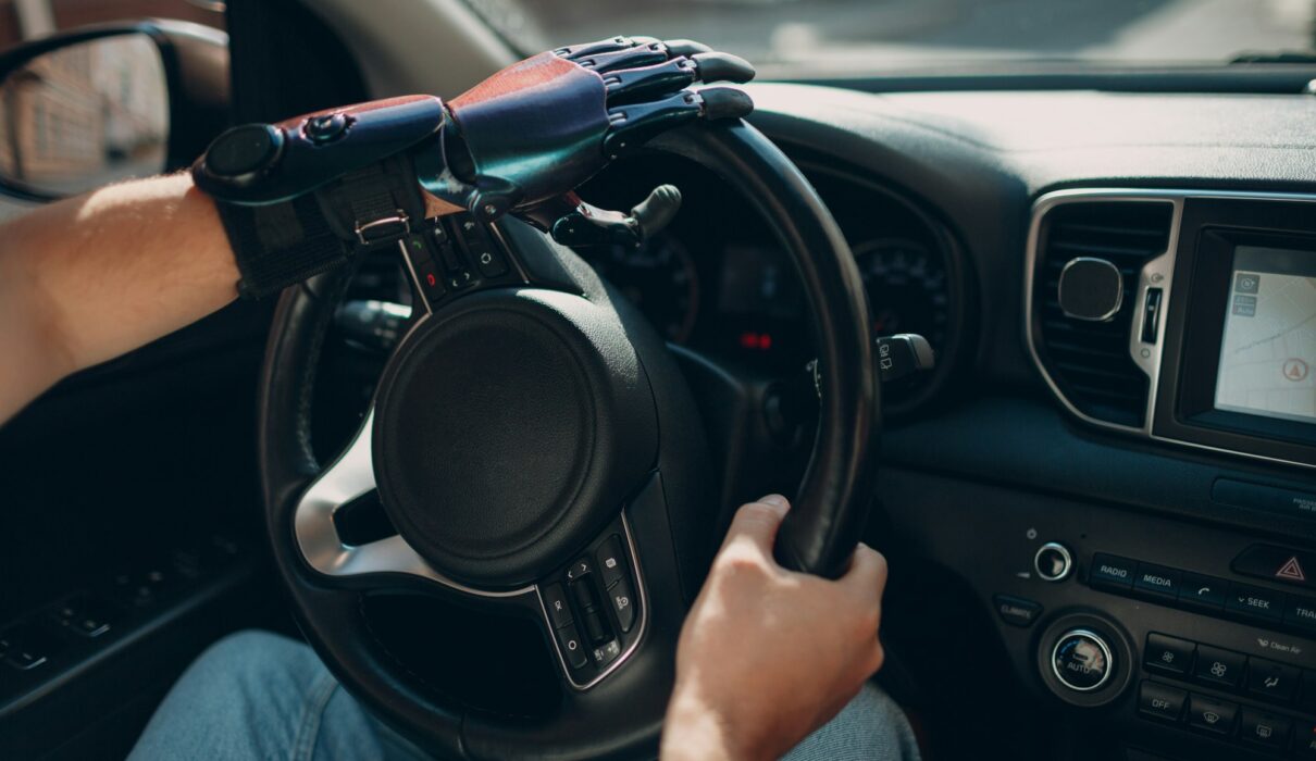 Young disabled man driver with artificial prosthetic hand driving vehicle car.