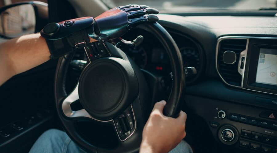 Young disabled man driver with artificial prosthetic hand driving vehicle car.